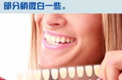一口健康的牙齿是什么颜色，健康的牙齿是什么色