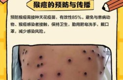 英国确认一例猴痘病例，第一例猴痘病例是在什么时候