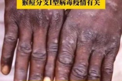 美国新病毒的最新消息，最新美国病毒感染