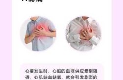 心梗的前兆是什么症状哪里疼（心梗前兆1～7天的表现）