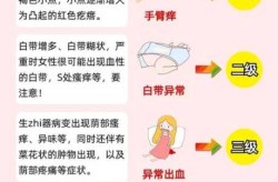 如何判断自己感染hpv，怎么判断hpv感染了