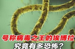 埃博拉病毒为什么会突然消失（埃博拉病毒被消灭了吗）