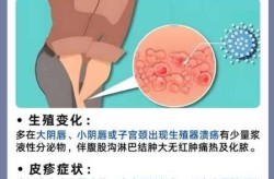 怎么判断自己得了性疾病，怎么判断自己中了梅毒