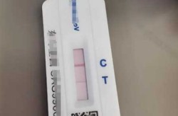 核酸检测阳性什么意思，核酸阳性意味着什么