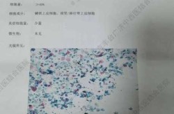 南昌新增1例无症状感染者，南昌发现1例无症状感染者