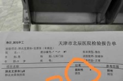 新冠弱阳性是算不算确诊，新冠弱阳性传染的概率是多少