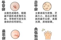无症状感染者是什么情况，无症状感染者怎么判断