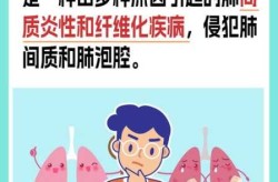 间质性肺炎是怎么回事，间质性肺炎俗称叫什么