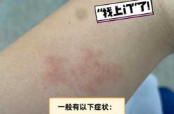 近期病毒感染什么症状，病毒感染的症状有哪些