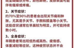 红斑狼疮病人最大寿命，红斑狼疮的寿命多长