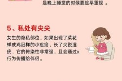 性的病毒是怎么引起的，女性下面病毒感染是什么引起的