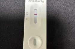 核酸检测咽拭子阴性啥意思，核酸检测为阴性是什么意思