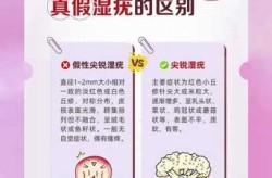感染hpv病毒怎么治疗，感染hpv怎样治疗