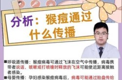 全国猴痘疫情最新消息，猴痘最新消息