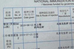 第四针疫苗什么时候打，脊灰疫苗第四针什么时候打