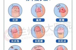 男人得了性疾病会传染吗，男士得了性疾病症状