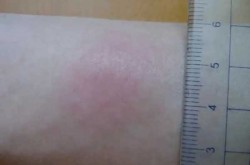孩子阳性一般几天自愈，小孩阳性一般几天能好