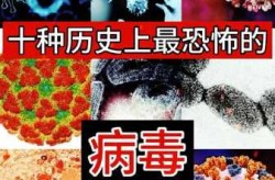 15种无法治愈的病毒，目前无法治疗的病毒有哪些