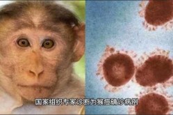 吴尊友分析本土病例再现，吴尊友回应重庆现猴痘病例