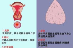得了hpv阳性怎么办，查出hpv阳性怎么办