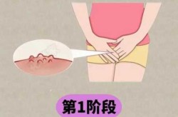 女生感染hpv初期症状，女性下面感染hpv早期症状