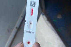 阳性报备阴性正常生活，阴性是正常还是阳性是正常
