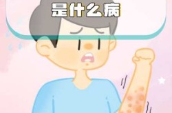 最近经常感染的病毒有哪些，最近都有哪些病毒出现