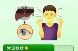 现在的三阳都有什么症状，三阳是什么症状