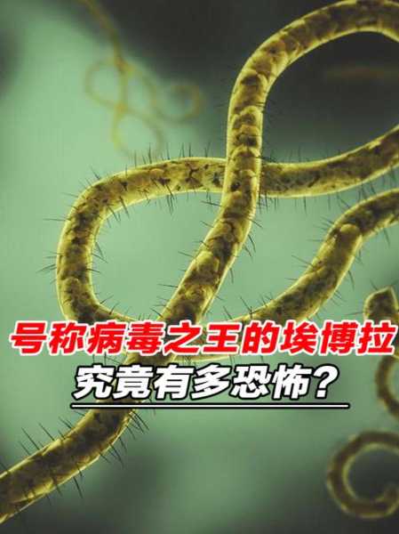 埃博拉病毒为什么会突然消失（埃博拉病毒被消灭了吗）