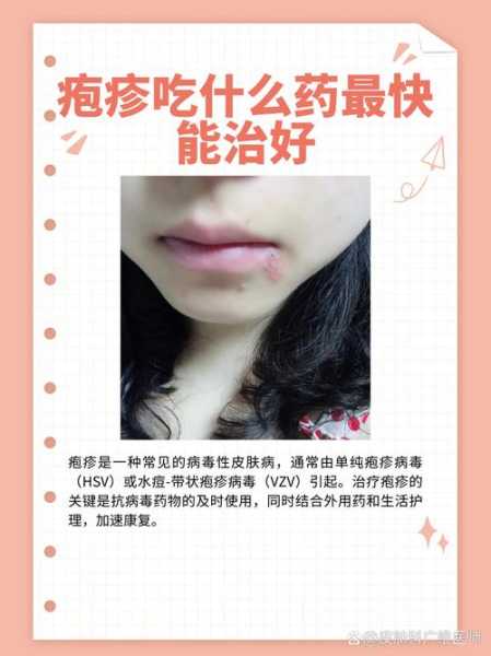kp2病毒感染会传染吗,病毒性疱疹会传染吗