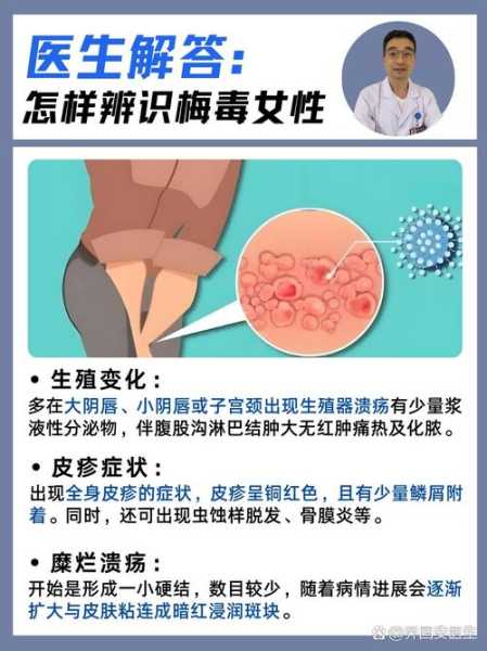 怎么判断自己得了性疾病,怎么判断自己中了梅毒