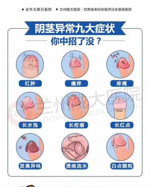 男人得了性疾病会传染吗,男士得了性疾病症状