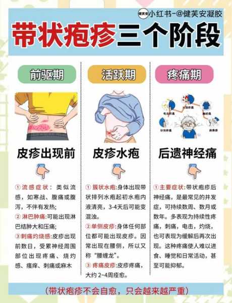 带状疱疹最好的治疗方法,带状疱疹最初的样子