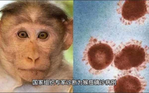 吴尊友分析本土病例再现，吴尊友回应重庆现猴痘病例