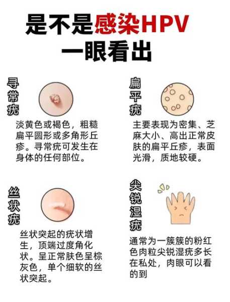 无症状感染者是什么情况，无症状感染者怎么判断