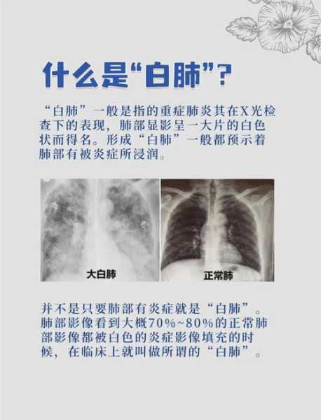 治疗白肺病哪个医院最好,白肺最好的三个医院