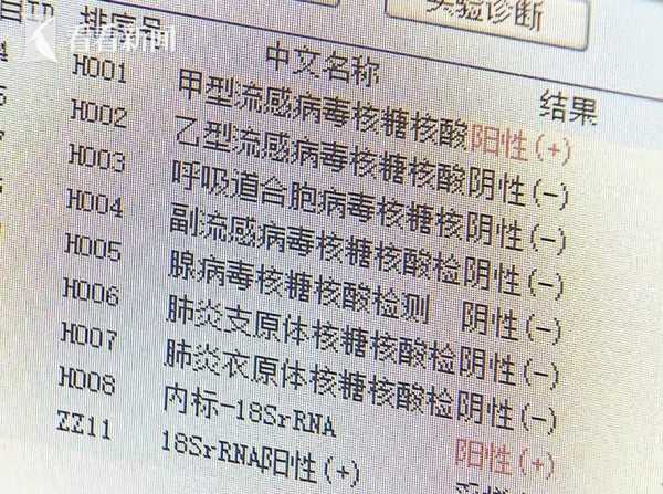 环境样本阳性什么意思,环境样本阳性与人阳性的不同