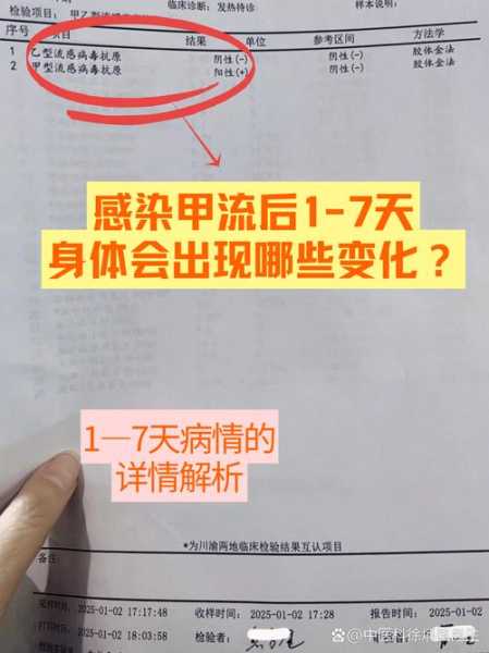 流感病毒第几天最严重，甲流一般第几天最严重