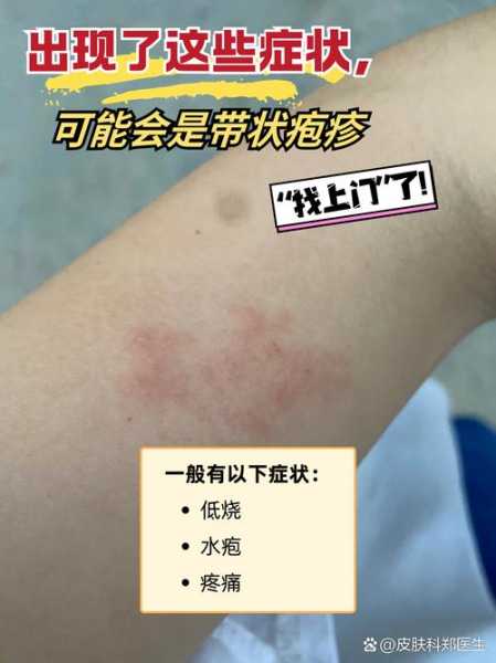 近期病毒感染什么症状，病毒感染的症状有哪些