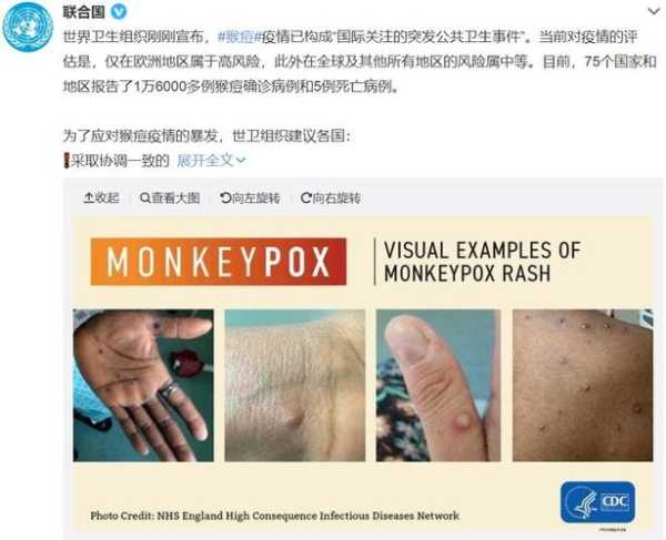 香港新增3例输入病例，香港今天最新确诊病例情况